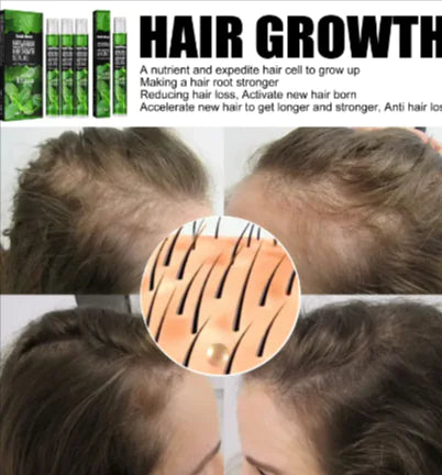 MintGrow Hair Spray